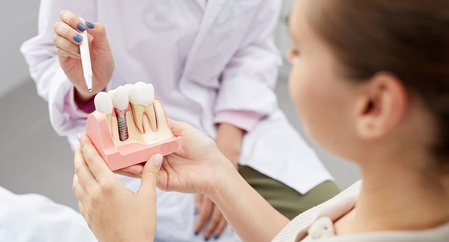 Dental Implant FAQs