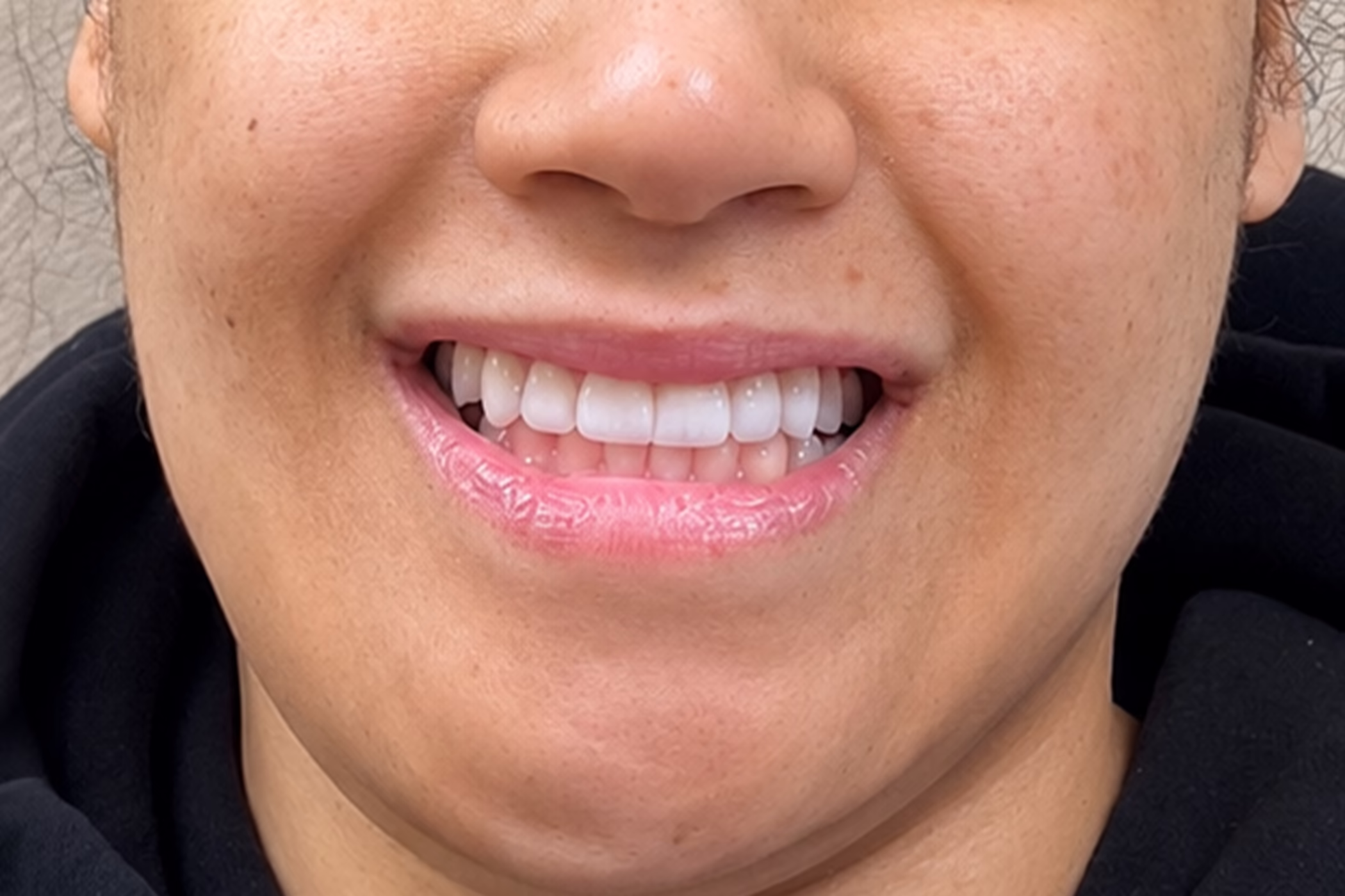 After cosmetic dentistry treatment at Bell Road Dentistry