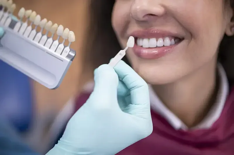 Porcelain veneers at Bell Road Dentistry in Surprise, AZ