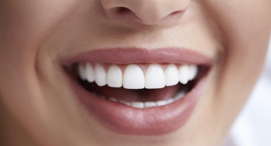 Dental sealants protecting molars at Bell Road Dentistry