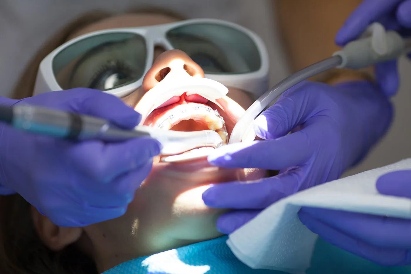 Dentures & Missing Teeth at Bell Road Dentistry