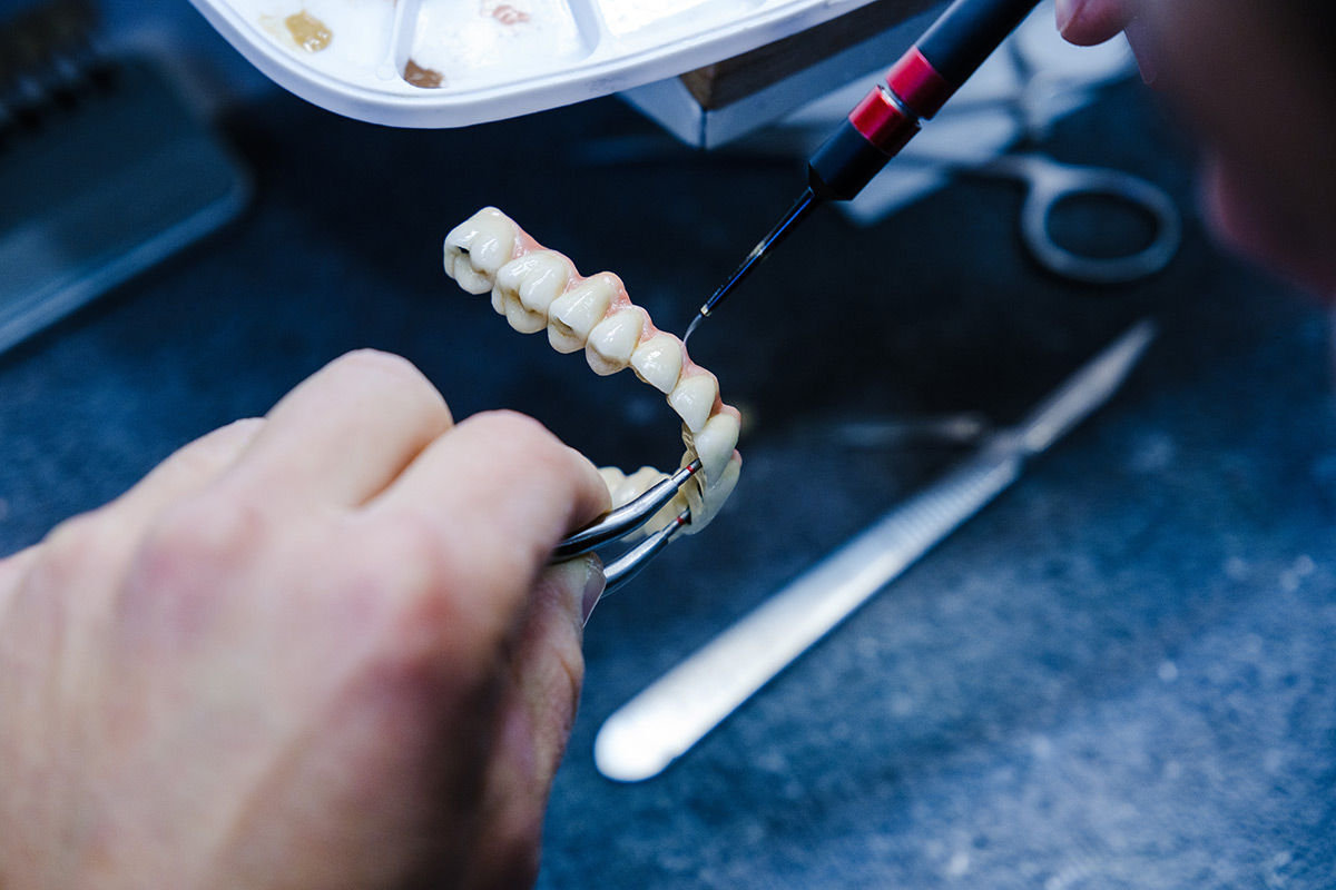 Technician preparing a dental restoration